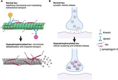 Neuronal Vulnerability of the Entorhinal Cortex to Tau Pathology in Alzheimer’s Disease